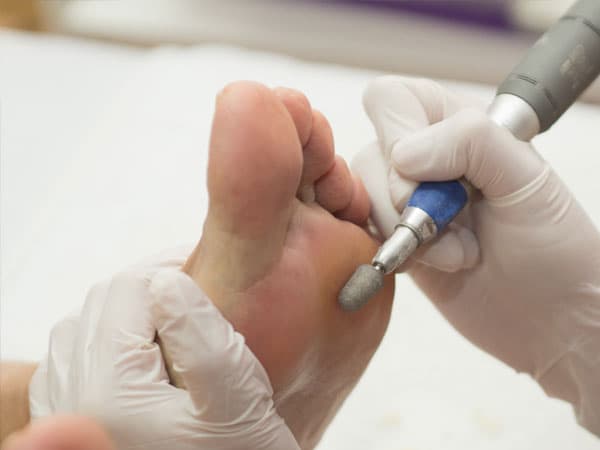 Servizos de podoloxía en Ferrol de calidade